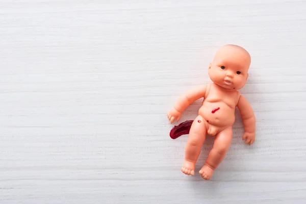 Cyclist Injury Laws What to Know If You Are Injured While Cycling